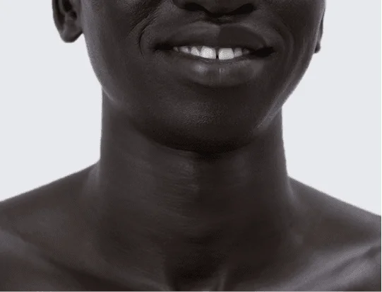 White Teeth